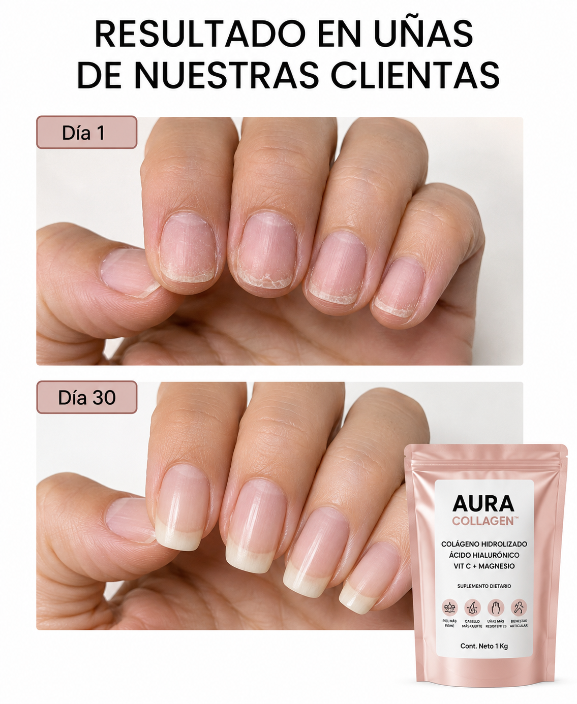 Colágeno Hidrolizado 4 en 1: Fortalece tu piel, cabello, uñas y articulaciones