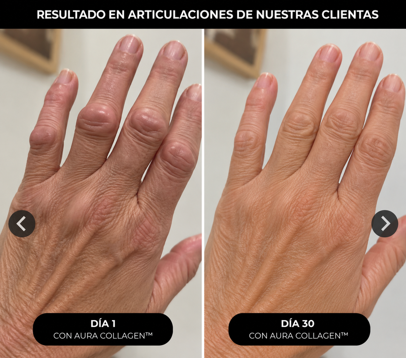 Colágeno Hidrolizado 4 en 1: Fortalece tu piel, cabello, uñas y articulaciones